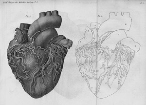 Lot 410, Auction  104, Bouillaud, J.B., Traité clinique des maladies du coeur