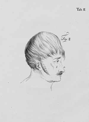 Lot 302, Auction  107, Ballif, Pierre, Description d'un nez artificiel et de plusieurs obturateurs 