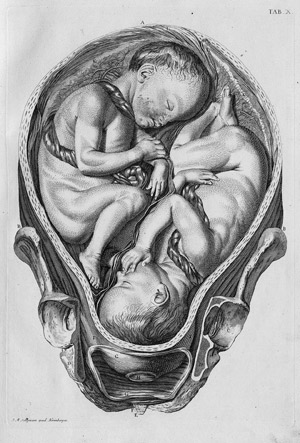 Lot 338, Auction  111, Smellie, Wilhelm, Tabulae anatomicae - Sammlung Anatomischer Tafeln zur Hebammenkunst