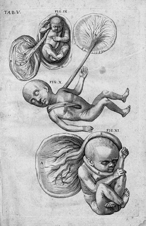 Lot 836, Auction  113, Fabricius ab Aquapendente, Hieronymus, Anatomices Et Chirurgiae In Florentissimo Gymnasio Patavino 
