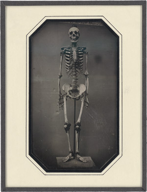 Lot 4035, Auction  113, Daguerreotypes, Skeleton