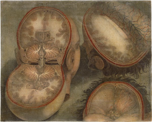 Lot 5522, Auction  115, Gautier-Dagoty, Jacques Fabien, Anatomische Ansichten des Kopfes 