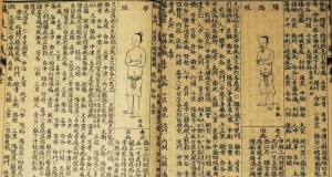 Los 1692 - Akupunktur-Lehrbuch - Zengbǔ huì tú zhēn jiǔ dà chéng. Supplementband eines umfassenden Akupunkturkompendiums - 4 - thumb