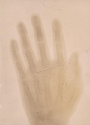 Lot 4090, Auction  124, X-ray Photography, X-ray photograph of hands