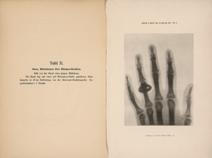 Los 4090 - X-ray Photography - X-ray photograph of hands - 1 - thumb