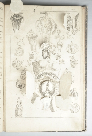 Los 219 - Hellwig, Christoph von - Anatomicum vivum Frankfurt und Leipzig, Hieronymus Philipp Ritschel, (1720).  - 6 - thumb